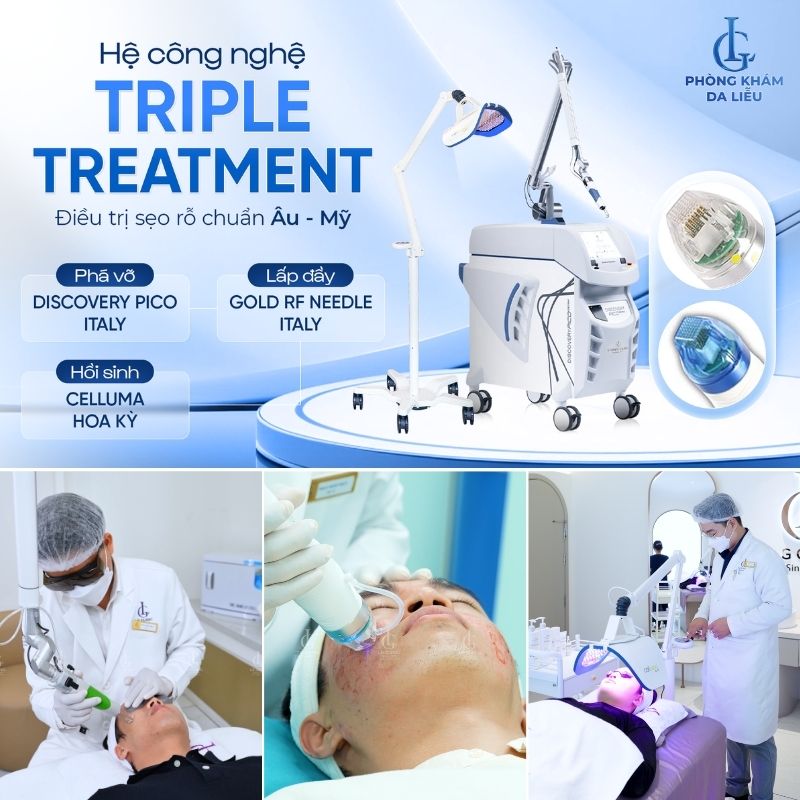 phương pháp trị seọ lõm triple treatment