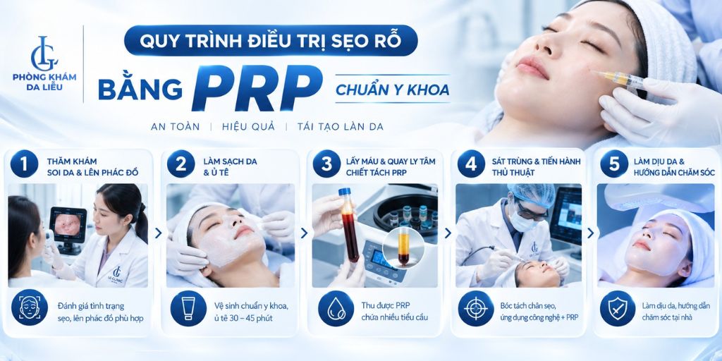 quy trình điều trị sẹo rỗ bằng prp