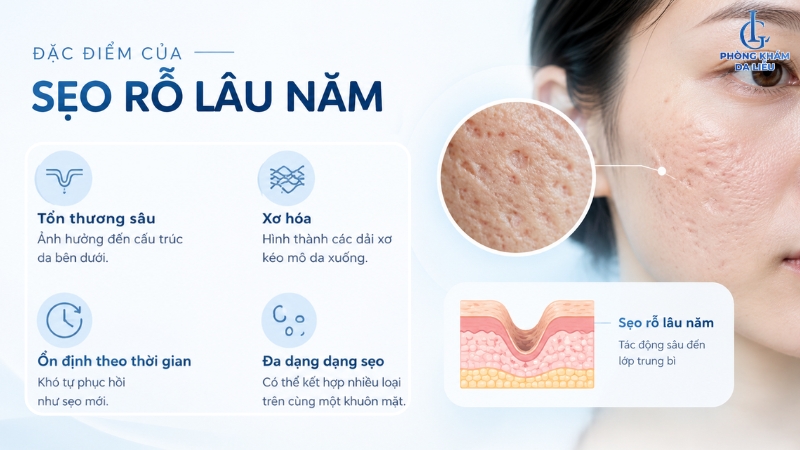Sẹo rỗ lâu năm có trị được không