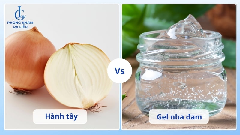 điều trị sẹo lõm từ hành tây và nha đam