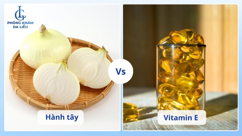 tự làm hành tây trị sẹo lõm tại nhà