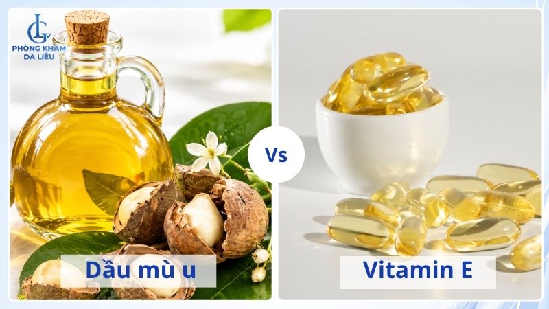 trị sẹo rỗ bằng dầu mù u và vitamin E