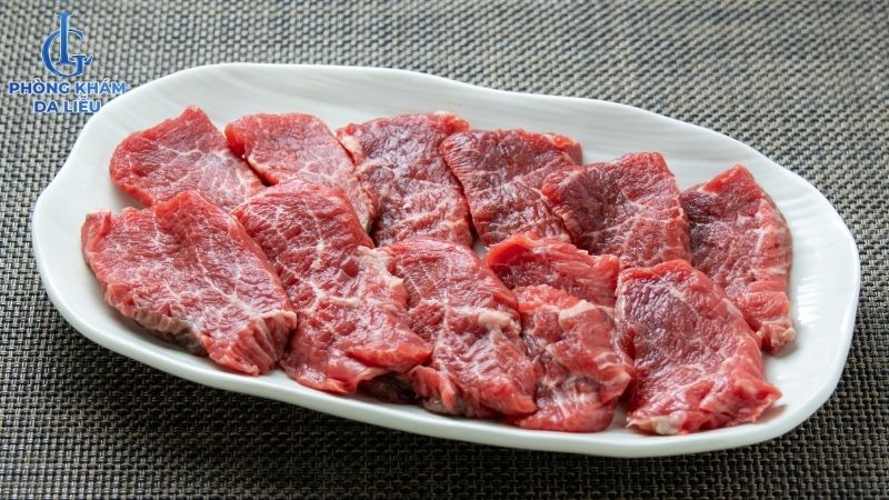 trị sẹo rỗ kiêng ăn thịt bò