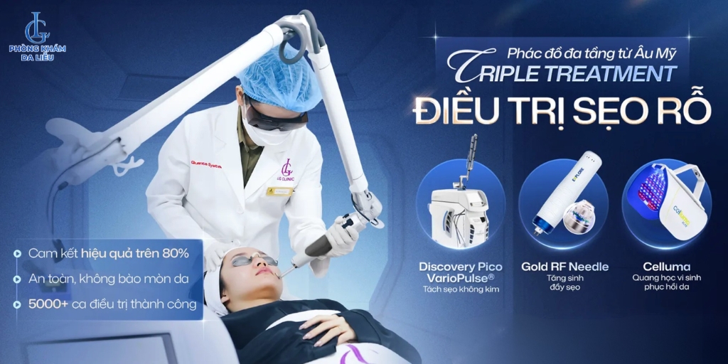 trị sẹo rỗ lâu năm