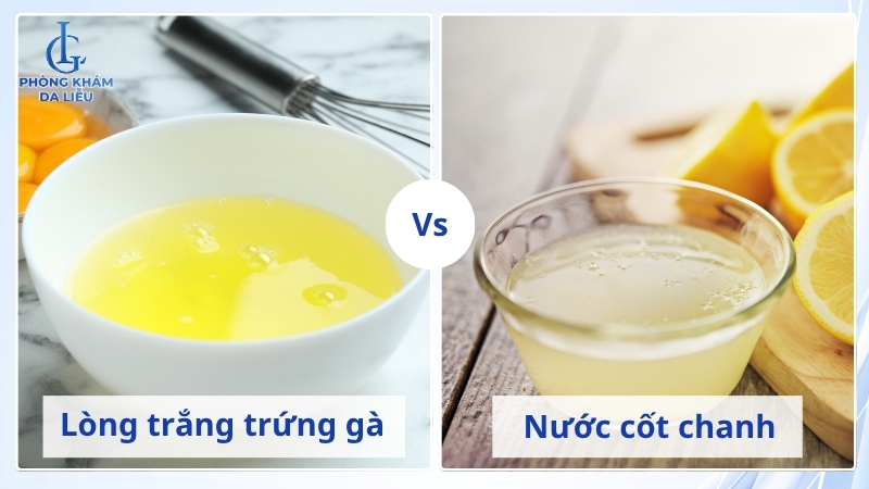 làm mặt nạ trứng gà trị sẹo rỗ