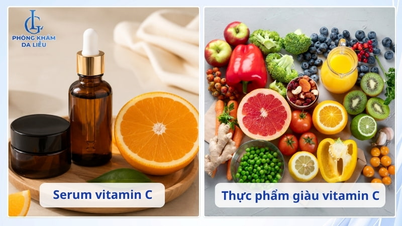 vitamin c có trị sẹo rỗ không