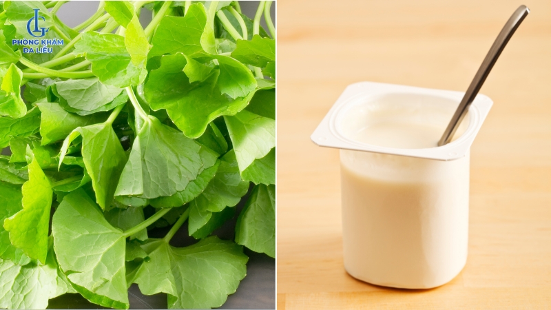 cách trị sẹo rỗ bằng rau má và sữa chua