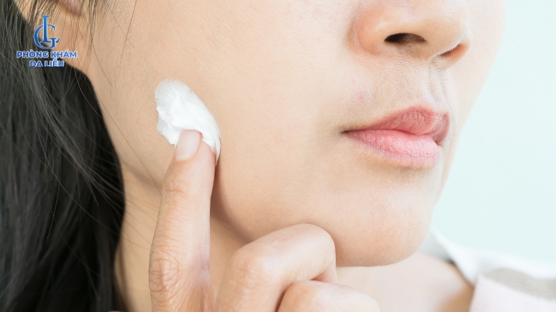 chăm sóc da giúp hỗ trợ điều trị sẹo lõm