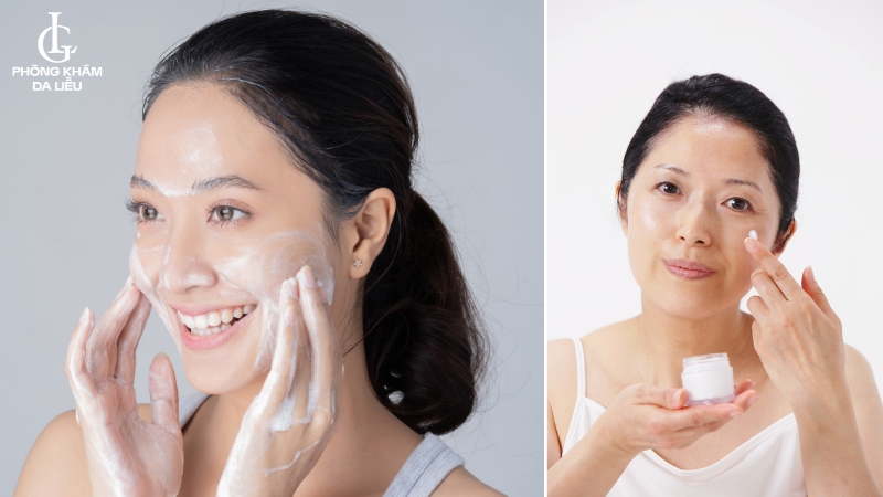 chăm sóc sau khi trị sẹo sau mụn