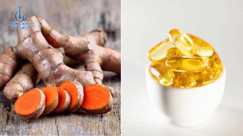 điều trị sẹo rỗ bằng nghệ tươi và Vitamin E