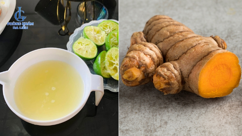 Nghệ tươi và chanh tươi điều trị sẹo rỗ