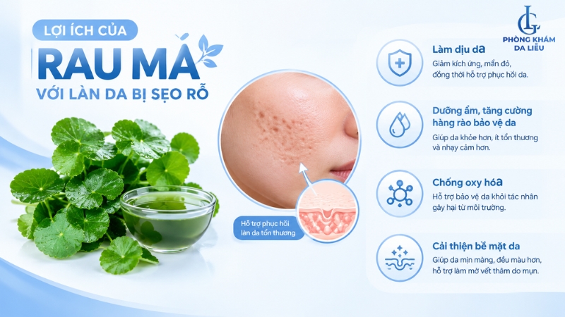 rau má trị sẹo rỗ được không