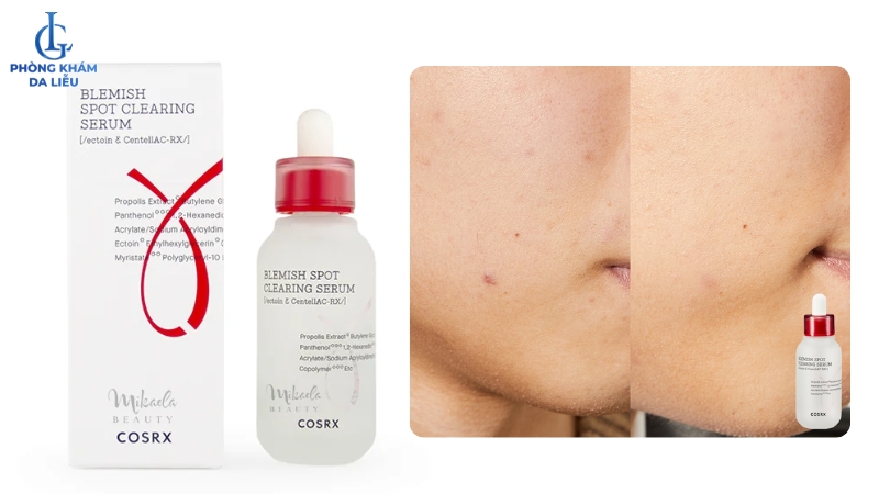 serum trị sẹo rỗ Hàn Quốc COSRX AC Collection Blemish Spot Clearing Serum