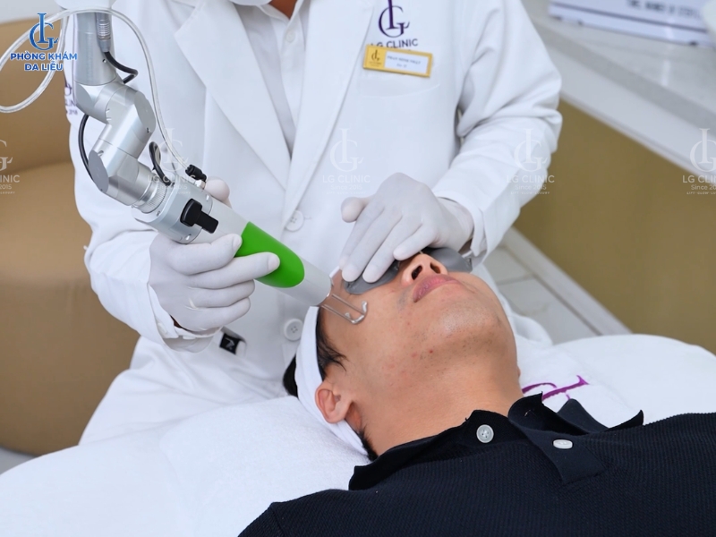 trị sẹo rỗ bằng laser