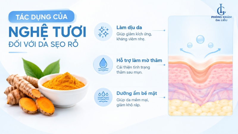 trị sẹo rỗ bằng nghệ tươi